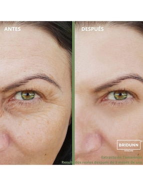 Tratamiento facial antiedad Bridunn Skincare