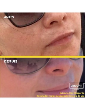 Tratamiento facial antiedad Bridunn Skincare