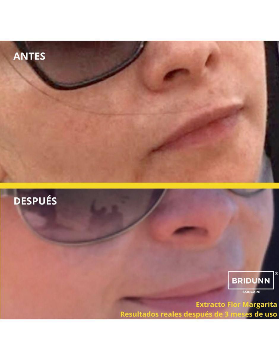 Tratamiento facial antimanchas 4