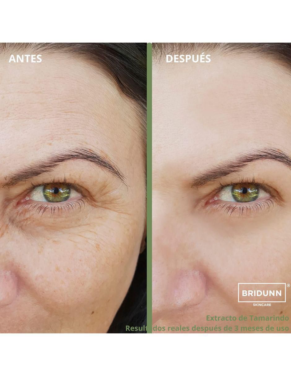 Tratamiento facial antiedad 7