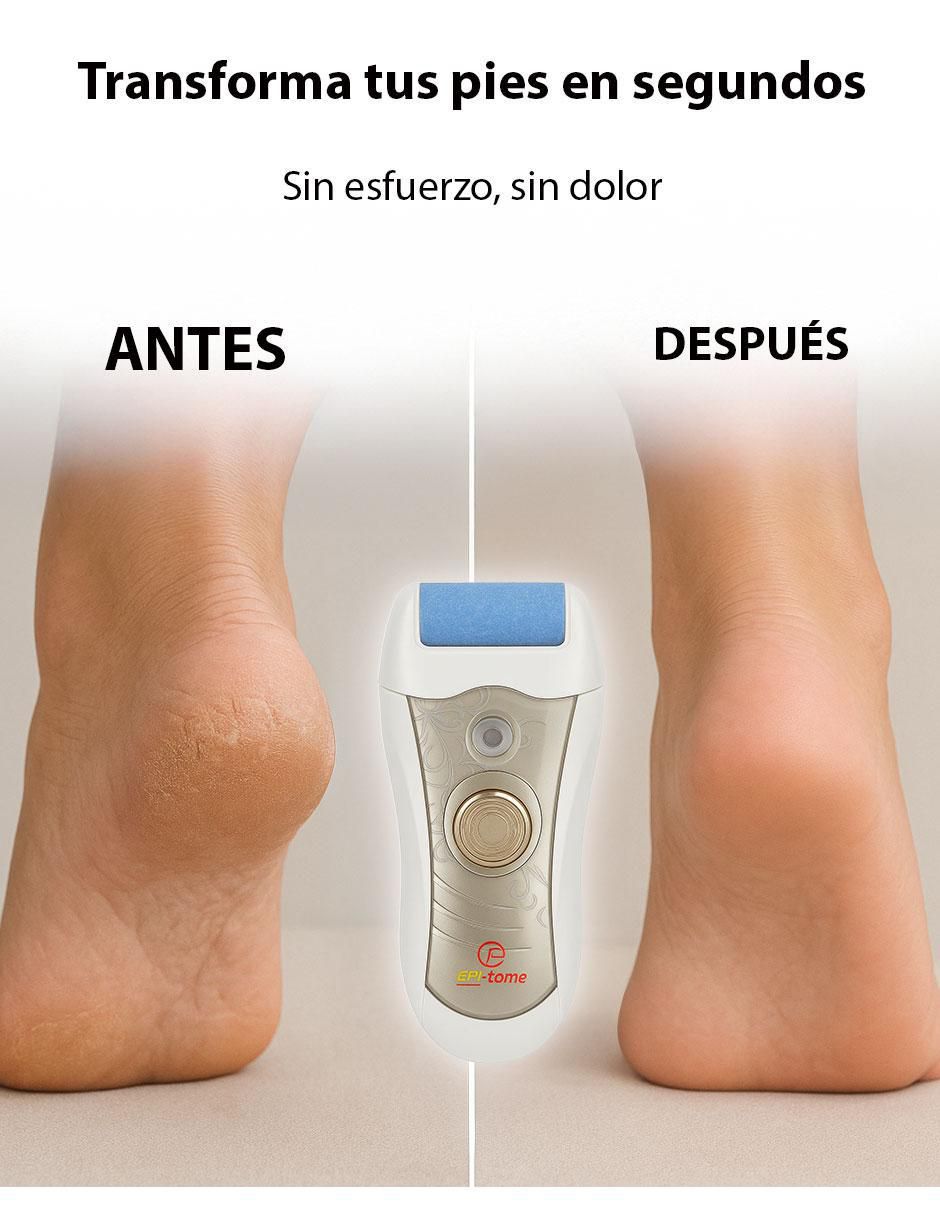 Depiladora para cuerpo pe6401 7